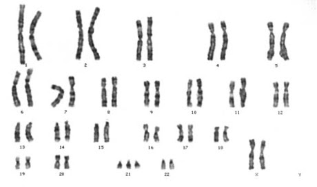 QCE生物学EA练习题-第15题
